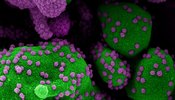 Novel Coronavirus SARS-Cov-2 purple and green